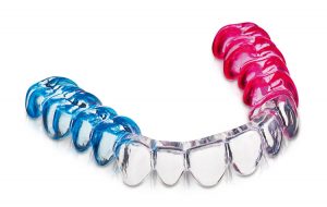 How to fabricate an occlusal splint using DURASOFT® PD