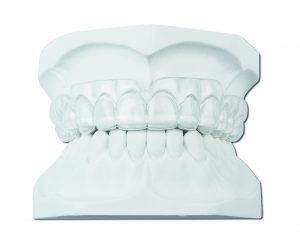 Manufacturing of an Osamu Retainer